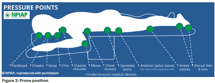 Abbildung: Pressure Points
